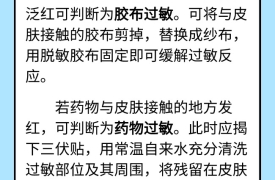 三伏贴怎么贴才有效？你需要注意这些事项