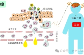 炎症时的各种表现是怎么形成的？